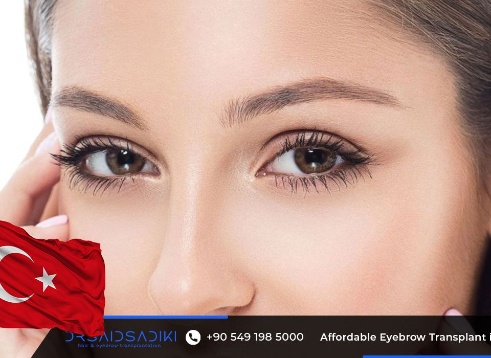 Affordable Eyebrow Transplant in Turkey