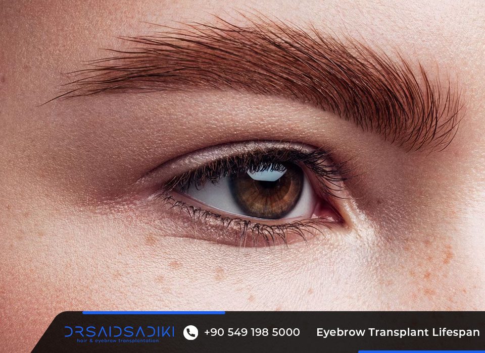 Eyebrow Transplant Lifespan