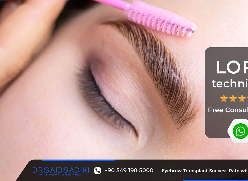 Eyebrow Transplant Success Rate