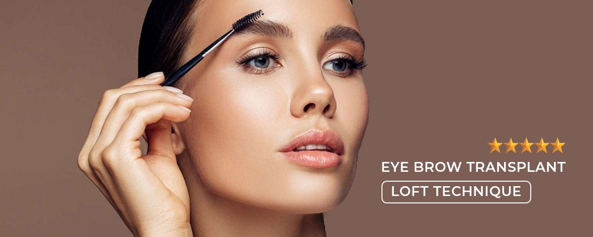 Best Eyebrow Transplant Technique