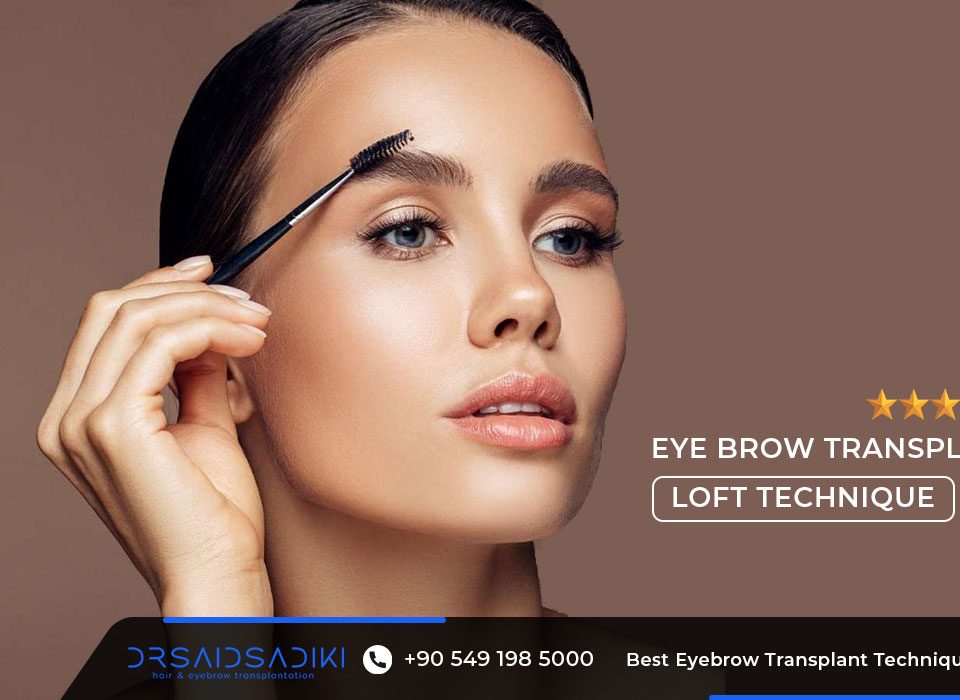 Best Eyebrow Transplant Technique