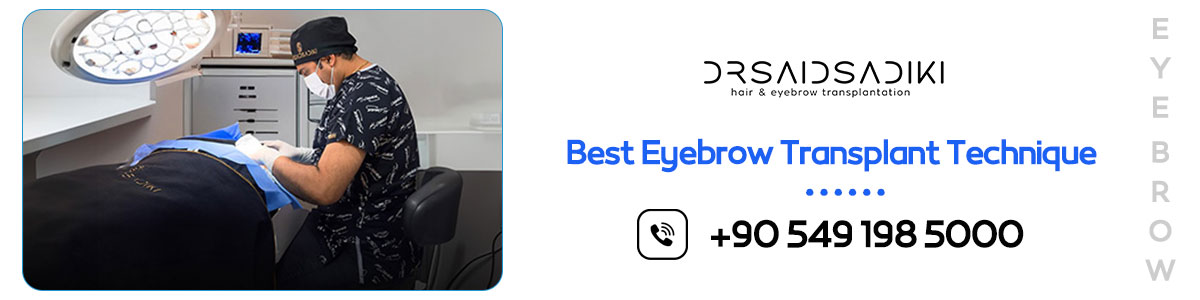 Best Eyebrow Transplant Technique in 2025 Natural Results