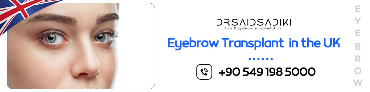 Best eyebrow transplant clinic in London with natural results