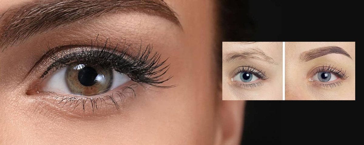 Eyebrow Transplant Side Effects