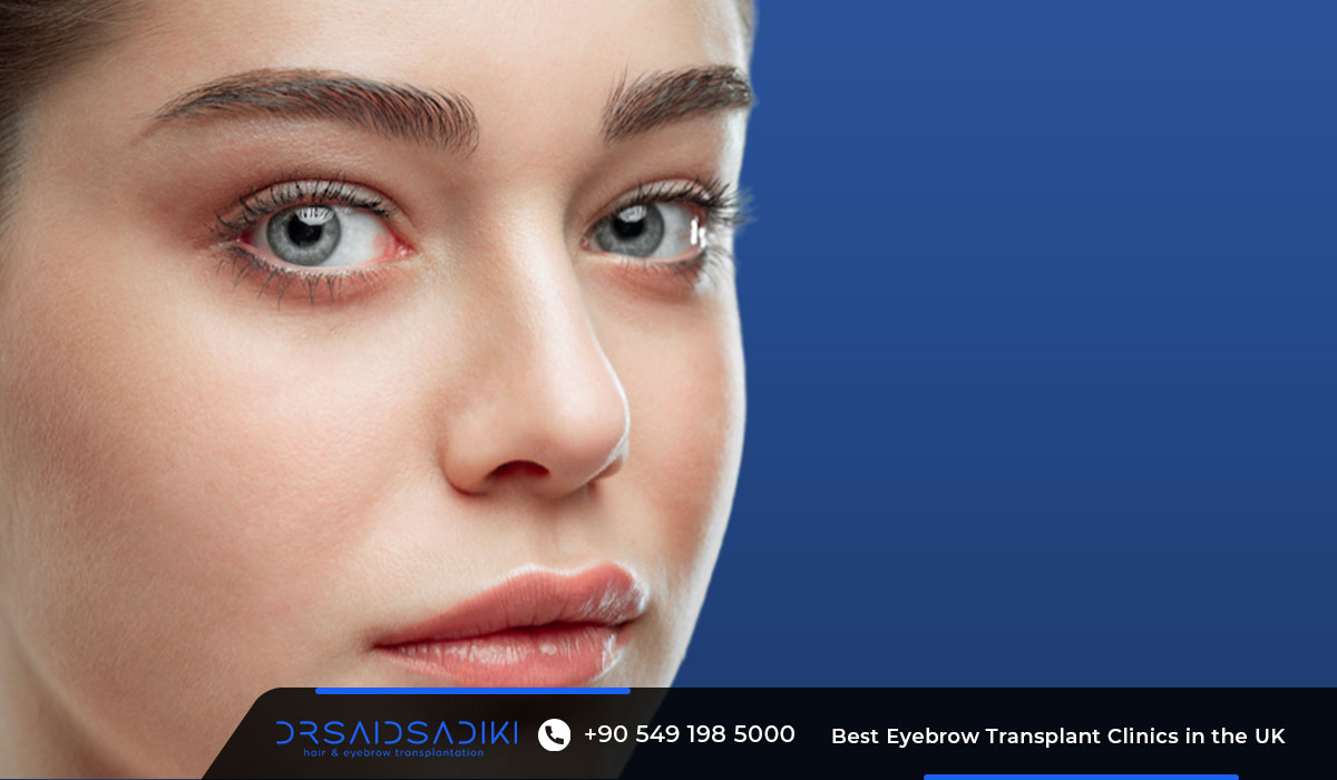 Eyebrow transplant procedure step-by-step in UK clinic