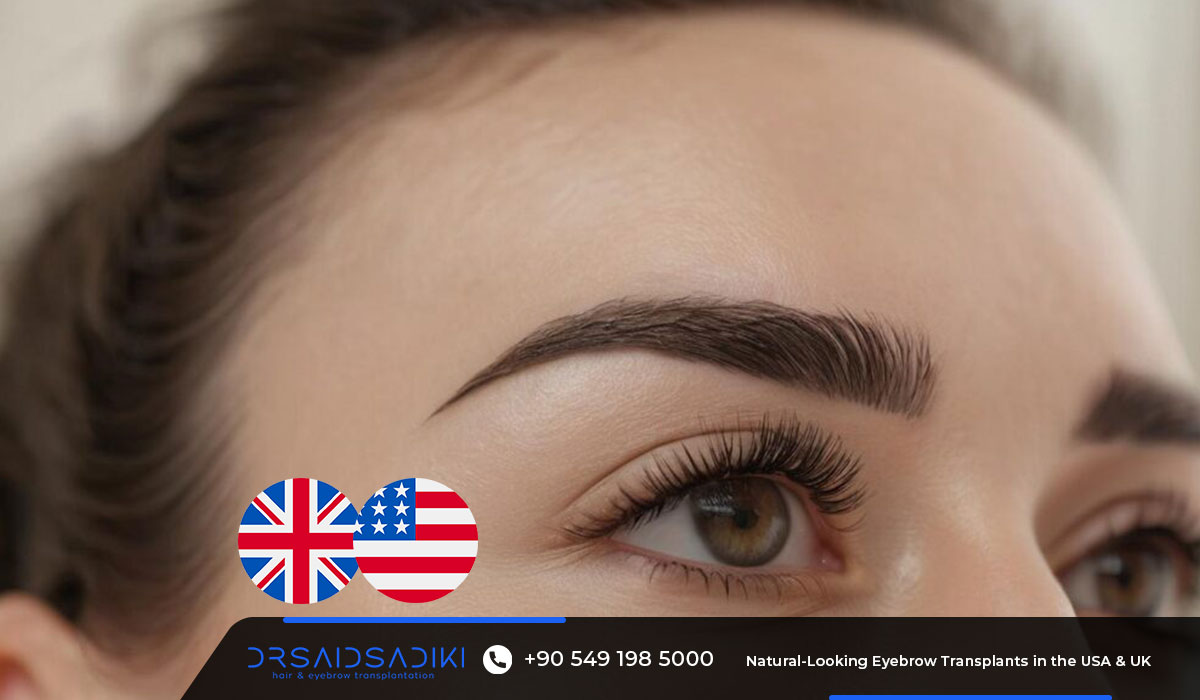 Natural-Looking Eyebrow Transplants in the USA & UK | LOFT Method 2025 27 Natural-Looking Eyebrow Transplants in the USA & UK
