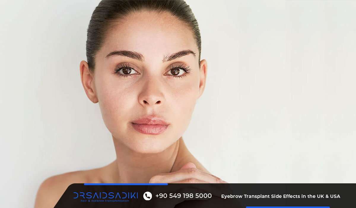 Natural results of eyebrow transplant with LOFT method