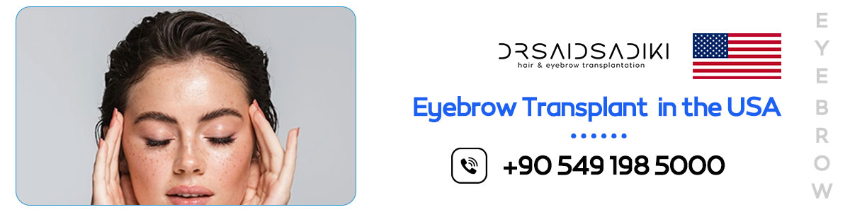  eyebrow transplant cost California