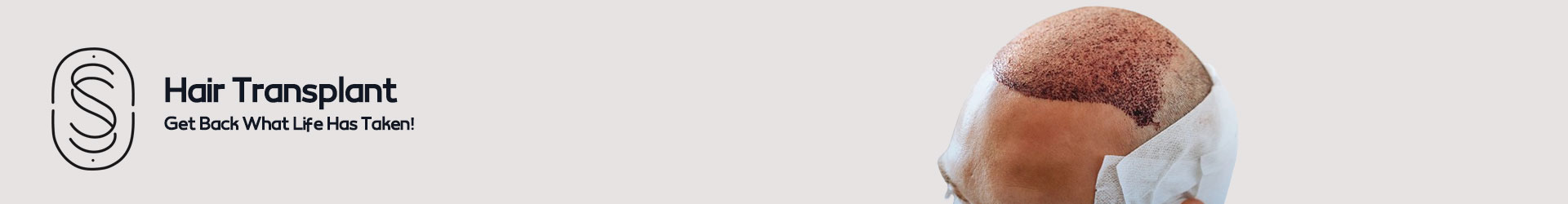 hair transplant istanbul